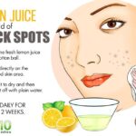 Lemon Juice A Natural Remedy for Dark Spots